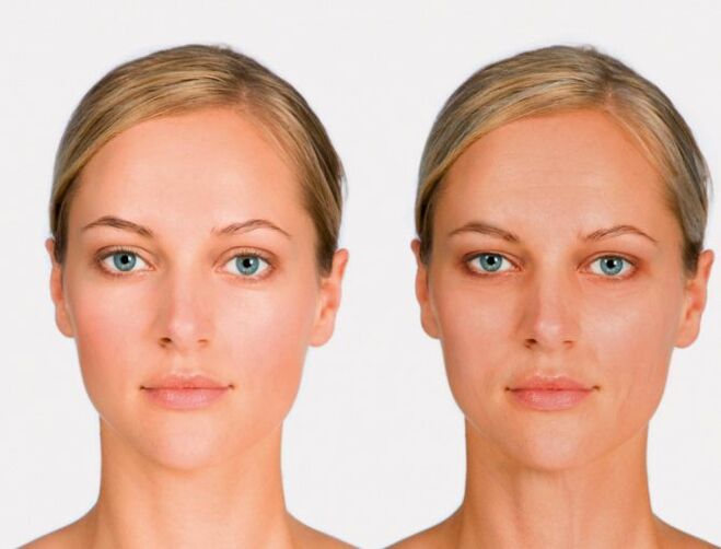 face after and before rejuvenation