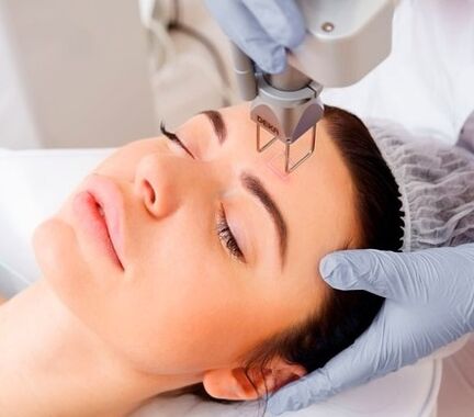 the essence of the fractional laser treatment of facial skin rejuvenation